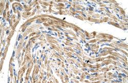 Anti-FADS1 Rabbit Polyclonal Antibody