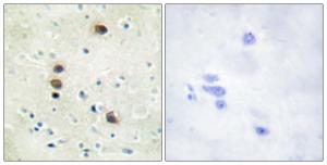 Antibody anti-PKC MU phospho SER205