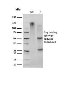 SDS-PAGE analysis of Anti-CD27 Antibody [203.6] under non-reduced and reduced conditions; showing intact IgG and intact heavy and light chains, respectively. SDS-PAGE analysis confirms the integrity and purity of the antibody.