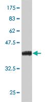 Anti-SIX4 Mouse Monoclonal Antibody [clone: 3B8]