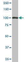 Anti-TRIM28 Mouse Monoclonal Antibody [clone: 1D11]