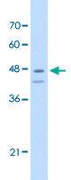 Anti-FAH Rabbit Polyclonal Antibody