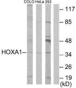 Western blot analysis of lysates from HeLa, COLO, and 293 cells using Anti-HOXA1 Antibody. The right hand lane represents a negative control, where the antibody is blocked by the immunising peptide.