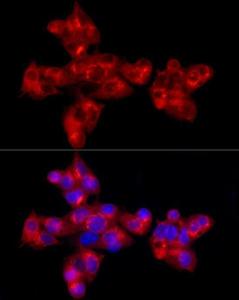 Immunofluorescence analysis of HepG2 cells using Anti-alpha 1 Antitrypsin Antibody [ARC54184] (A305682) at a dilution of 1:100 (40X lens). DAPI was used to stain the cell nuclei (blue)