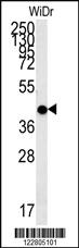 Anti-MC2R Rabbit Polyclonal Antibody