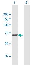 Anti-SLC27A5 Rabbit Polyclonal Antibody