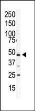 Anti-PIP4K2A Rabbit Polyclonal Antibody (HRP (Horseradish Peroxidase))