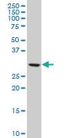 Anti-TBCB Mouse Polyclonal Antibody