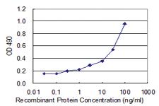 Anti-AKR1D1 Polyclonal Antibody Pair