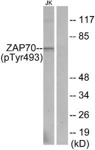 Anti-ZAP70 Rabbit Polyclonal Antibody