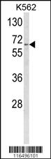 Anti-IL9R Rabbit Polyclonal Antibody