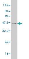 Anti-SIX4 Mouse Monoclonal Antibody [clone: 5E1]