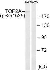 Western blot analysis of lysates from RAW2647 cells treated with TNF 20ng/ml 5' using Anti-TOP2A (phospho Ser1525) Antibody The right hand lane represents a negative control, where the antibody is blocked by the immunising peptide