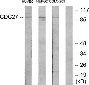 Western blot analysis of lysates from HUVEC, HepG and COLO205 cells using Anti-H-NUC Antibody. The right hand lane represents a negative control, where the antibody is blocked by the immunising peptide