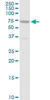 Anti-SLC27A5 Rabbit Polyclonal Antibody