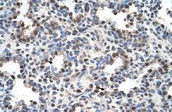 Anti-FAM134B Rabbit Polyclonal Antibody