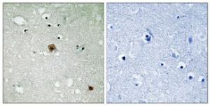 Immunohistochemical analysis of paraffin-embedded human brain using Anti-TOP2A (phospho Ser1525) Antibody The right hand panel represents a negative control, where the antibody was pre-incubated with the immunising peptide