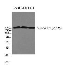 Western blot analysis of 293T 3T3 COLO using Anti-TOP2A (phospho Ser1525) Antibody