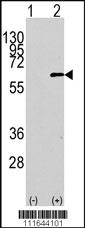 Anti-AKT1 Rabbit Polyclonal Antibody