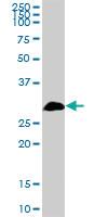 Anti-TBCB Mouse Polyclonal Antibody