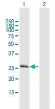 Anti-RGS20 Mouse Polyclonal Antibody