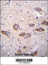 Anti-SLC25A31 Rabbit Polyclonal Antibody