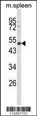 Anti-CYP24A1 Rabbit Polyclonal Antibody