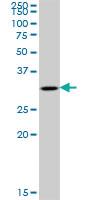 Anti-TBCB Mouse Polyclonal Antibody