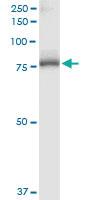 Anti-SLC27A5 Rabbit Polyclonal Antibody