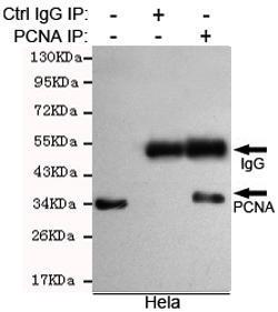 Anti-PCNA Mouse Monoclonal Antibody [clone: 13k94]