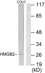 Western blot analysis of lysates from COLO205 cells using Anti-HMGB2 Antibody. The right hand lane represents a negative control, where the antibody is blocked by the immunising peptide.