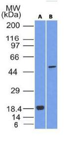 Western blot analysis of (A) recombinant SOX10 protein and (B) A375 cell lysate using Anti-SOX10 Antibody [SOX10/992]