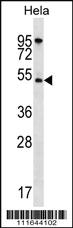 Anti-AKT1 Rabbit Polyclonal Antibody