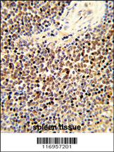 Anti-DLX5 Rabbit Polyclonal Antibody