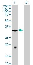 Anti-TBCB Mouse Polyclonal Antibody