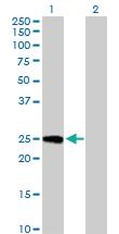 Anti-GINS3 Mouse Polyclonal Antibody