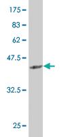 Anti-SIX4 Mouse Monoclonal Antibody [clone: 5D4]