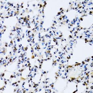 Immunohistochemistry analysis of paraffin-embedded rat lung using Anti-ERK1 Antibody (A12556) at a dilution of 1:100 (40x lens). Perform microwave antigen retrieval with 10 mM PBS buffer pH 7.2 before commencing with IHC staining protocol.