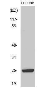 Western blot analysis of various cells using Anti-HMGB2 Antibody