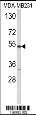 Anti-CYP2A13 Rabbit Polyclonal Antibody