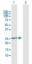 Anti-SOHLH2 Rabbit Polyclonal Antibody