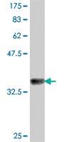 Anti-EIF4G1 Mouse Polyclonal Antibody