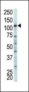 Anti-HK2 Rabbit Polyclonal Antibody