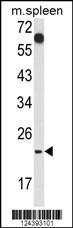 Anti-CD7 Rabbit Polyclonal Antibody (PE (Phycoerythrin))