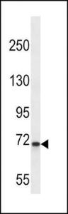 Anti-KLKB1 Rabbit Polyclonal Antibody (HRP (Horseradish Peroxidase))