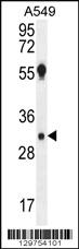 Anti-AQP12B Rabbit Polyclonal Antibody