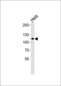 Anti-HK2 Rabbit Polyclonal Antibody (AP (Alkaline Phosphatase))