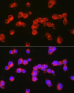 Immunofluorescence analysis of Neuro-2a cells using Anti-5 hT2A Receptor Antibody (A307137) at a dilution of 1:200 (40X lens). DAPI was used to stain the cell nuclei (blue)