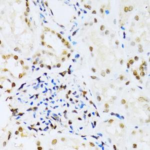 Immunohistochemistry analysis of paraffin-embedded human kidney using Anti-ERK1 Antibody (A12556) at a dilution of 1:100 (40x lens). Perform microwave antigen retrieval with 10 mM PBS buffer pH 7.2 before commencing with IHC staining protocol.