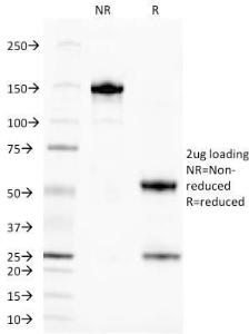 SDS-PAGE analysis of Anti-TAG72 Antibody [CA72/145] under non-reduced and reduced conditions; showing intact IgG and intact heavy and light chains, respectively. SDS-PAGE analysis confirms the integrity and purity of the antibody.